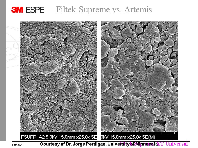 Filtek Supreme vs. Artemis Courtesy of Dr. Jorge Perdigao, University of Minnesota Filtek Supreme vs. Artemis Courtesy of Dr. Jorge Perdigao, University of Minnesota